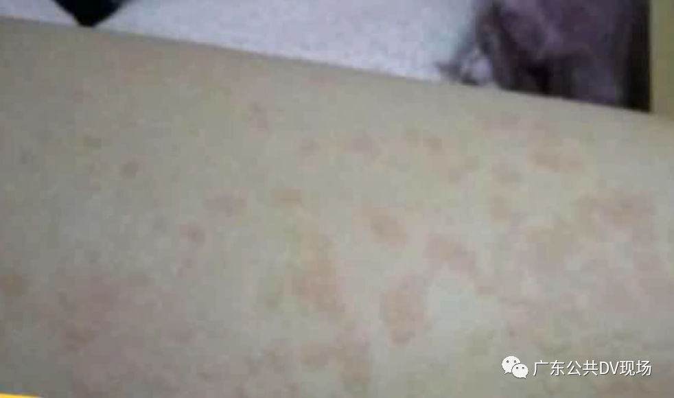 982x580_0c5a571232bb90e8.jpg