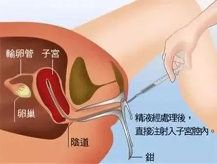 445x336_a5d312bd02e74f10.jpg