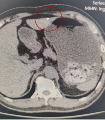 微信图片_20220514114045.png 205x234_22394d8da5771bce.jpg