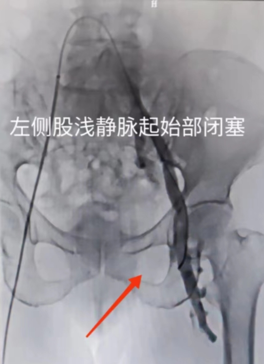 538x741_7cfe9cd8d09bf415.jpg