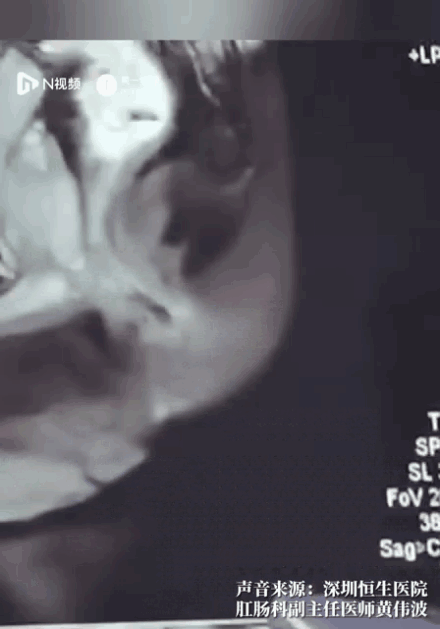 640?wx_fmt=gif&wxfrom=5&wx_lazy=1