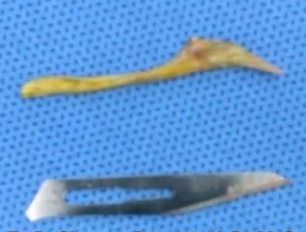 640?wx_fmt=png&wxfrom=5&wx_lazy=1&wx_co=